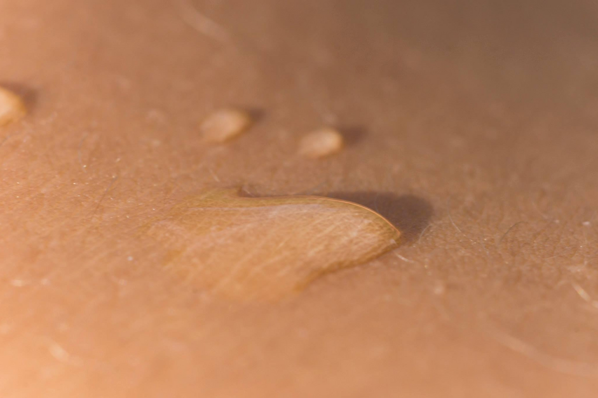 huid grootste orgaan